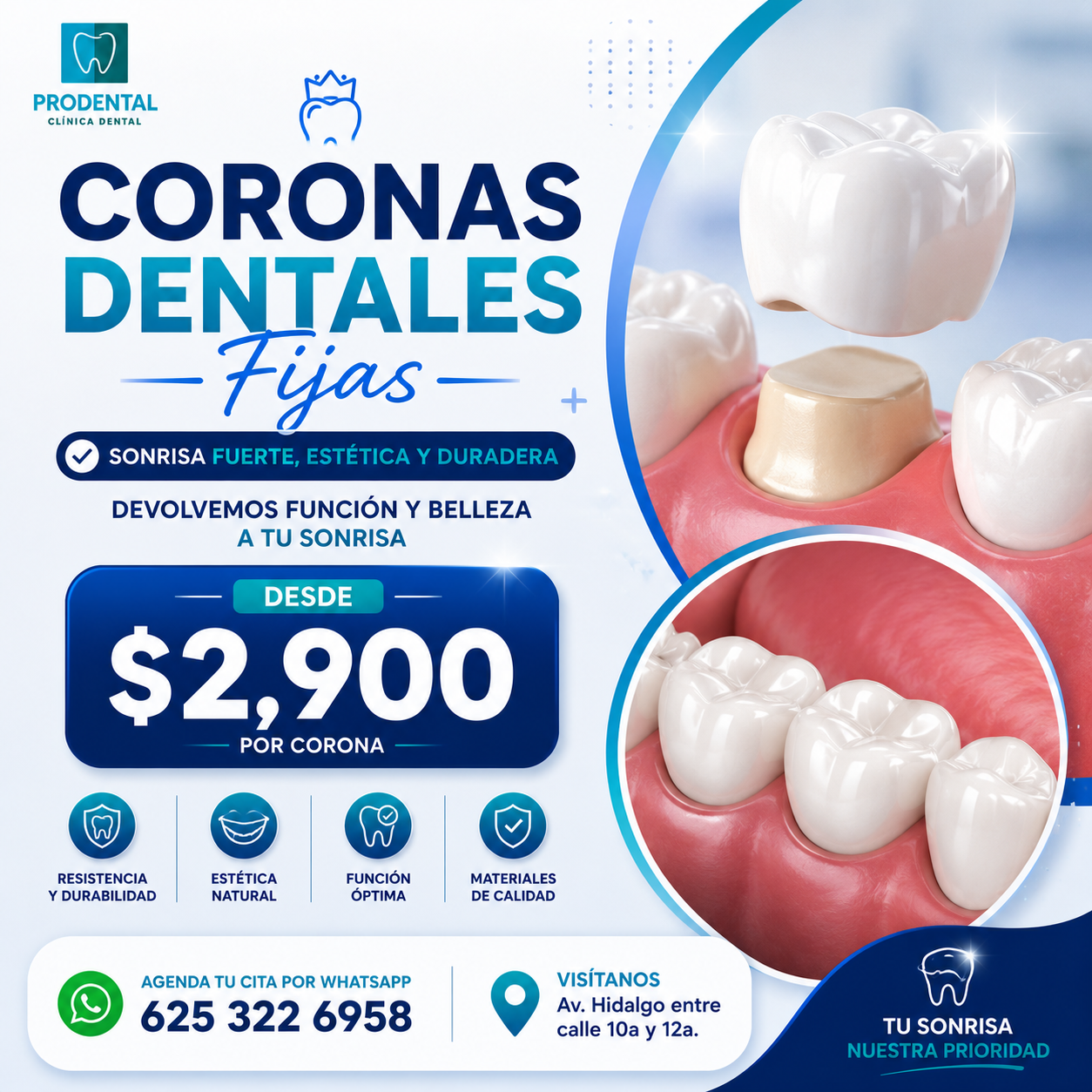 Promoción de Coronas dentales fijas
