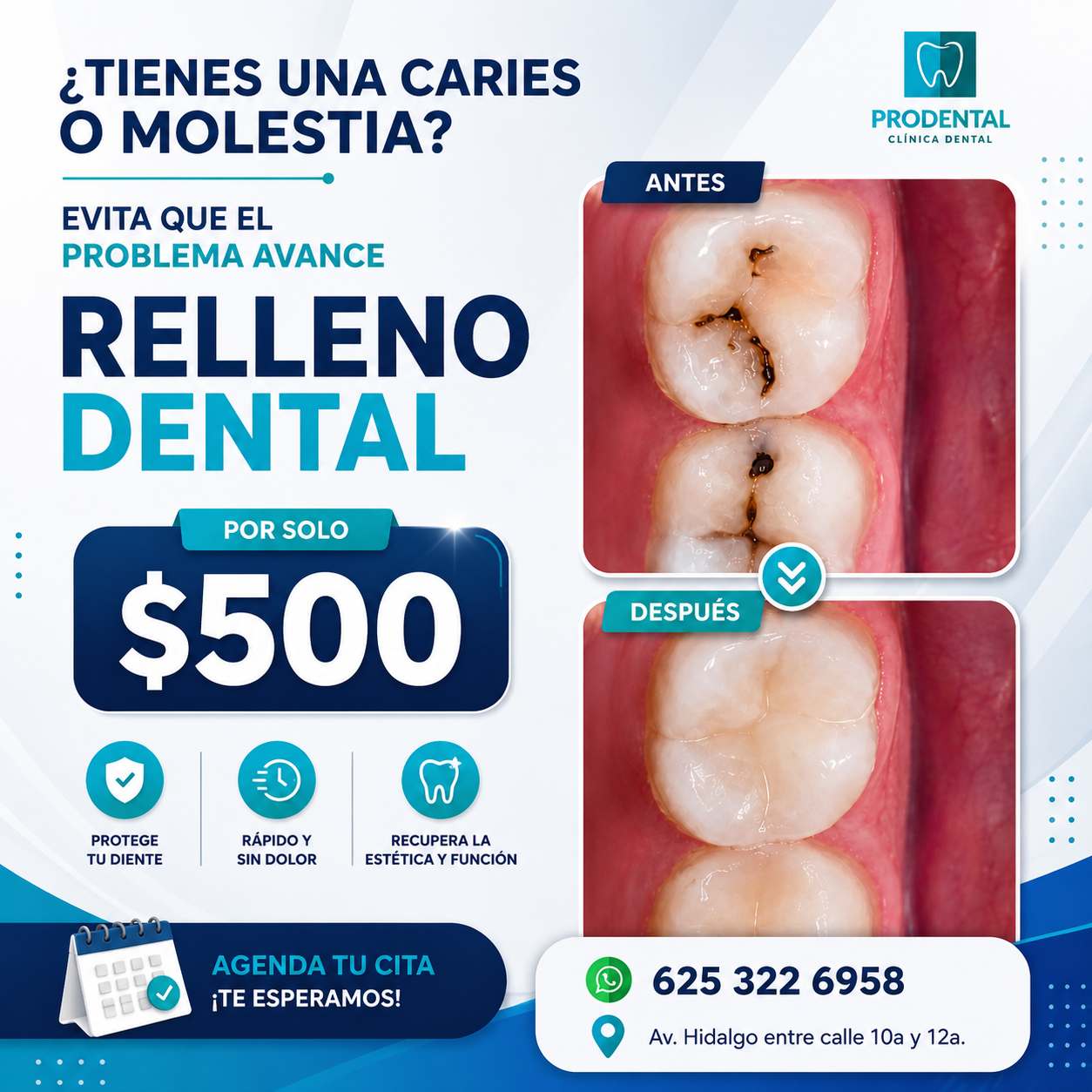 Promoción de Relleno dental